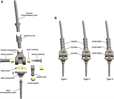 Effect of carbon-fiber-reinforced polyetheretherketone on stress distribution in a redesigned tumor-type knee prosthesis: a finite element analysis